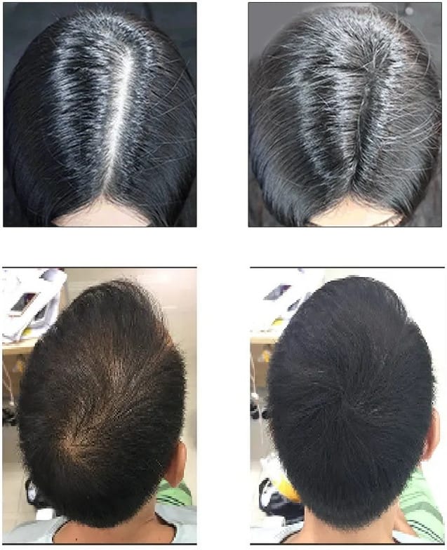 Imported King-yes Instant Hair Thickener Spray 30ml Black & Brown