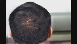 Imported King-yes Instant Hair Thickener Spray 30ml Black & Brown